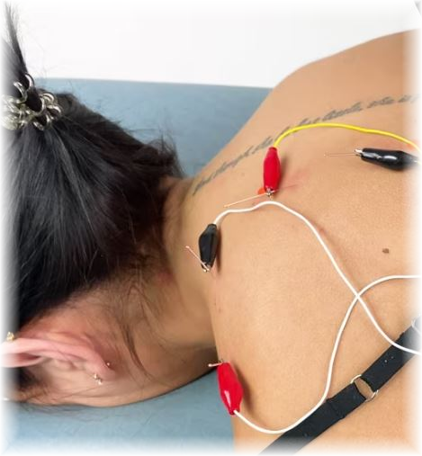 Elettroagopuntura linica- Terapia del dolore -Dr. Mihaela Petrican
